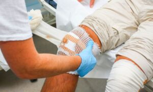 Advanced Wound Dressing Market