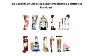 Top Benefits of Choosing Expert Prosthetics & Orthotics Providers