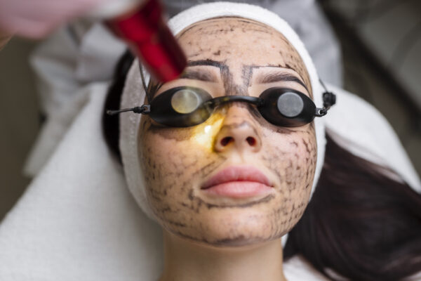 Skin-lightening-treatments-for-dark-spots
