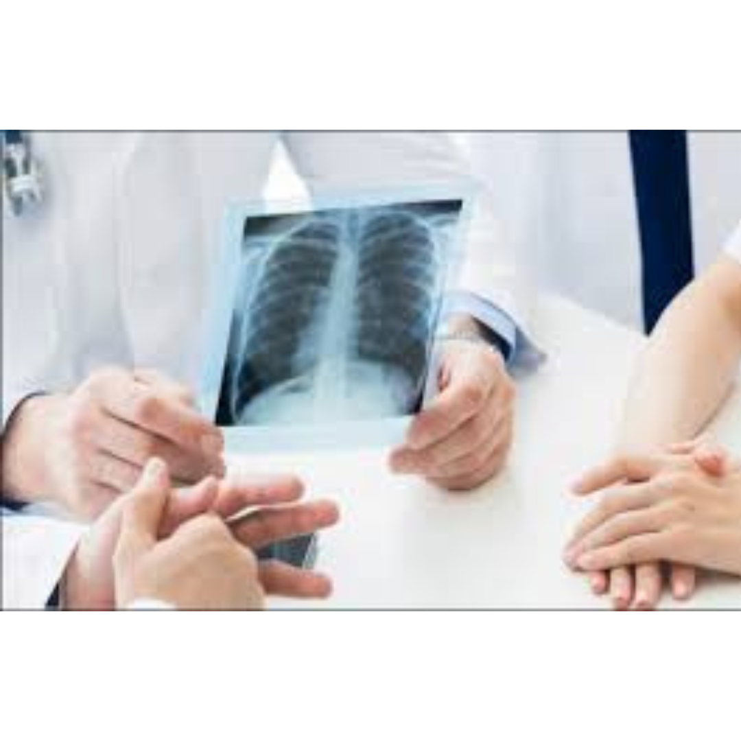 Best X-Ray Lab in Bangalore