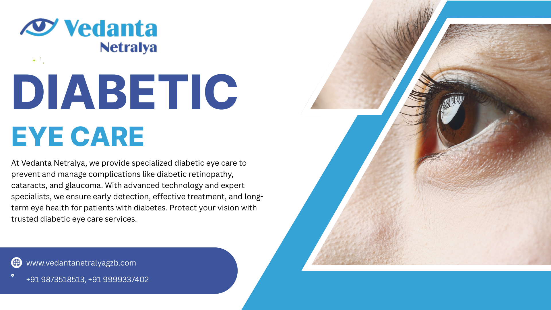Diabetic Eye Care