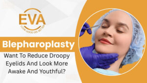 blepharoplasty in delhi